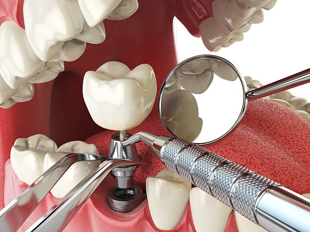 Best Broken or Cracked Tooth Emergency Dentist in Cheboygan, MI